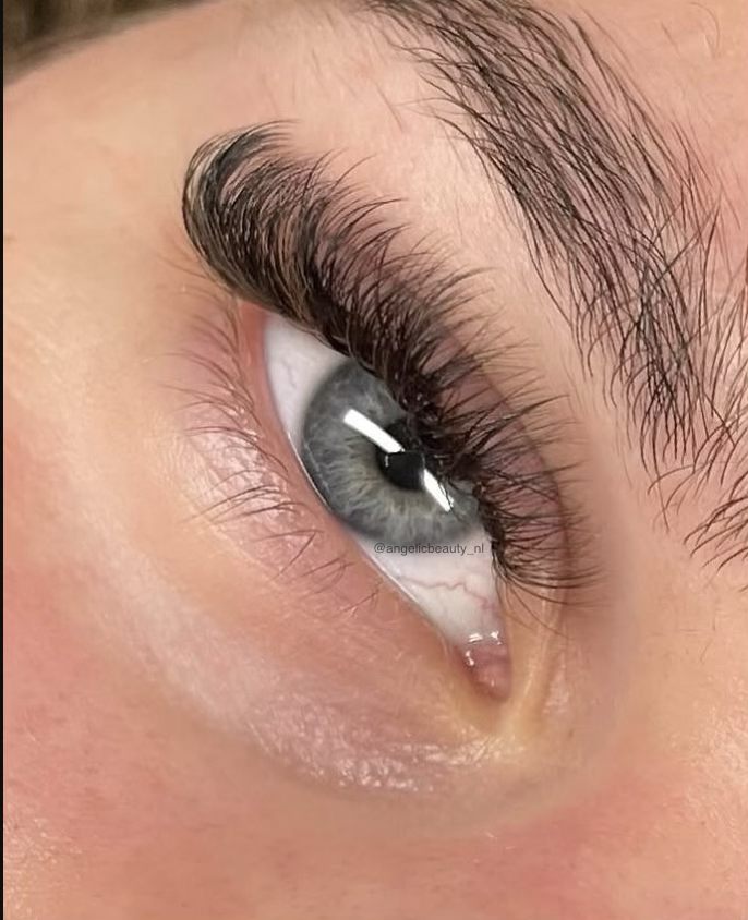 Resultaat van een Volume-behandeling bij Angelic Beauty